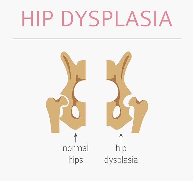 hip dysplasia in dog