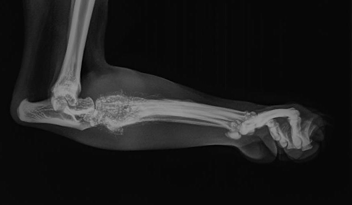 An x-ray of a cat leg with osteomyelitis